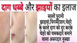 pimples dark circle ka ayurvedic treatment in Hindi चेहरे को बनाए गोरा [upl. by Nellda]