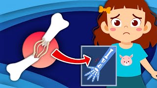 Learn How Broken Bones Heal  Human Body Songs For Kids  KLT [upl. by Lemkul631]