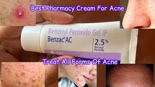 Benzac AC Cream Review  benzac ac 25 review  Benzoyl Peroxide For Acne [upl. by Loftis]