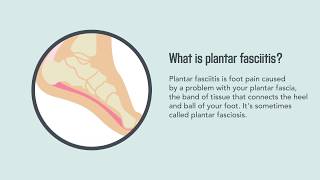 Plantar Fasciitis Causes Symptoms and Treatment  Merck Manual Consumer Version [upl. by Iralam276]