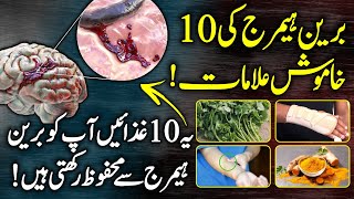 What Happens In Brain Hemorrhage  Symptoms Causes And Treatment Urdu Hindi [upl. by Robinette133]