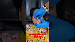 Chiropractic treatment for nasal septum deviation drrajneeshkant worldfamouschiropractor [upl. by Nomad396]