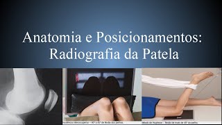 Anatomia Radiográfica Patela PA Perfil Settegast Hughston Merchant Hobbs [upl. by Eleets]