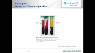 New technology for integrated collection stabilization amp purification of cffDNA [upl. by Anitsirhc]