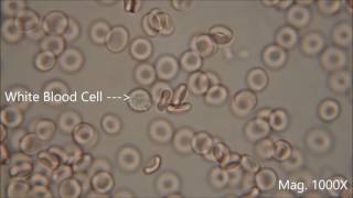 Red blood cells under the microscope hypo and hypertonic solutions [upl. by Aillil935]