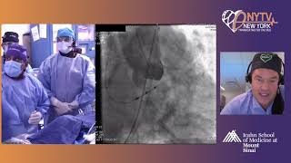 Live Case 2 – Evolut Pro CoreValve [upl. by Sophey]