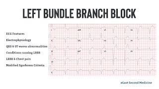 Left Bundle Branch Block  ECG Features Electrophysiology Causes amp Differential Diagnosis [upl. by Ahmar]