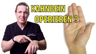 Kahnbeinfraktur Operieren oder nicht [upl. by Dreeda474]