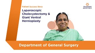 Laparoscopic Cholecystectomy amp Giant Ventral Hernioplasty  Yashoda Hospitals Hyderabad [upl. by Nessim]