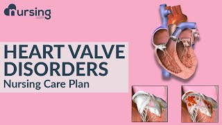 How heart valve disorders occur and caring for heart valve disorders Nursing Care Plan [upl. by Bala]