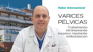 Varices Pélvicas Tratamiento mínimamente invasivo mediante embolización [upl. by Marget]