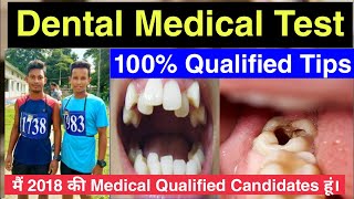 Dental Medical Test Check  SSCGD Dental Medical Test  Indian Army Dental Medical Test [upl. by Ahseenat]