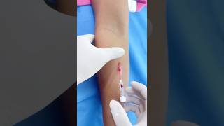 Canalización en la cara anterior del antebrazo💉🩸 [upl. by Hgielhsa]