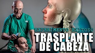 INMORTALIDAD PRIMER TRASPLANTE DE CABEZA DE UN SER HUMANO  SERGIO CANAVERO NEUROCIRUJANO [upl. by Eniamahs]