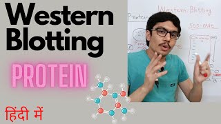 Western Blotting Western Blotting techniqueWestern Blotting of protein basics explained in hindi [upl. by Sprung]