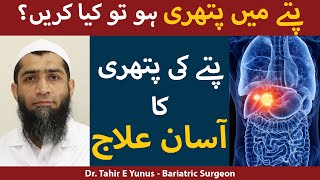 Pittay Ki Pathri Ka Ilaj In Urdu  Gallstones Treatment In UrduHindi  Dr Tahir E Yunus [upl. by Walling732]