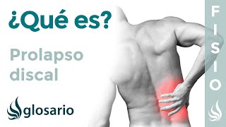 PROLAPSO DISCAL  Qué es qué estructuras afecta síntomas causas y tratamiento fisioterapéutico [upl. by Bettye]