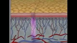 Granulation Tissue  General Pathology Practical   Learning Pathology [upl. by Pat271]