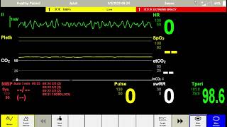 Anesthesia Scenario [upl. by Menon]