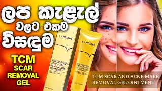 TCM Scar Removal Gel  For Acne Marks Scars And Stretch Marks  Cosmetics Sri Lanka  Beauty Lovers [upl. by Vladamar]