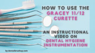 How to use the Gracey 1112 Curette [upl. by Brennen]