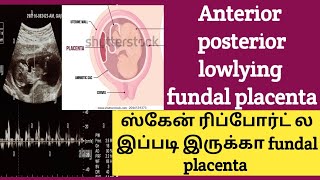 Placental location Scan report during pregnancy anterior posterior low lying and previea placenta [upl. by Lasser686]