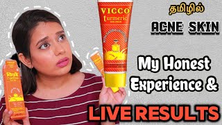 I TRIED VICCO CREAM FOR A WEEK ON ACNE SKIN AND THIS HAPPENED  Vicco Turmeric cream Review in Tamil [upl. by Solracesoj]