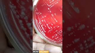 GRAM POSITIVE VS GRAM NEGATIVE BACTERIA GRAM POSITIVE VS GRAM NEGATIVE BACTERIA [upl. by Ainoval768]