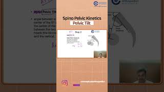 Spino Pelvic Kinetics Pelvic Tilt by Dr Vishal M Huggi  Orthopedics Residency [upl. by Ahtibat]