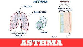 Asthma Patophysiology [upl. by Trev]