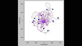 Myosin 6 in breast cancer cells – Video S1 479151 [upl. by Atazroglam924]