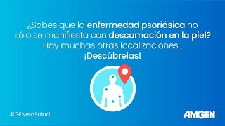 Descubre las diferentes localizaciones de la enfermedad psoriásica [upl. by Ordway]