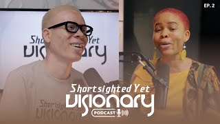 Understanding Albinism  SYV PodcastS1EP2  Ft Jessica Hyacinth [upl. by Nageem]