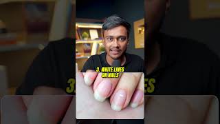 Check Your NAILS NOW shortsindia millionairemindset viralvideo [upl. by Anerol]