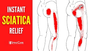 How to Instantly Fix Sciatica Pain [upl. by Nicoli65]