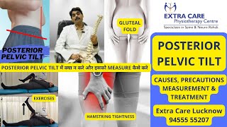 Posterior Pelvic Tilt  Precautions amp Measurement via Posture Lab  Muscle Imbalance correction [upl. by Enasus694]