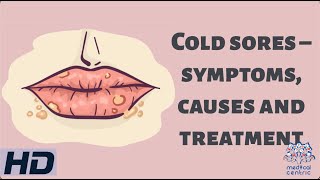 Cold Sores – Symptoms Causes and Treatment [upl. by Suidaht]