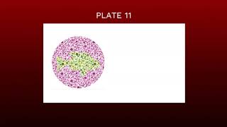 TEST YOURSELF  COLOR BLIND CHILD TEST [upl. by Bobette]