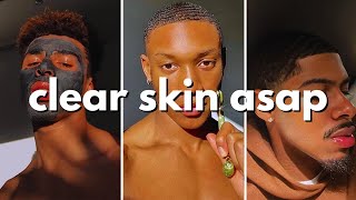 how to get clear skin for guys asap no bs guide [upl. by Benjy746]