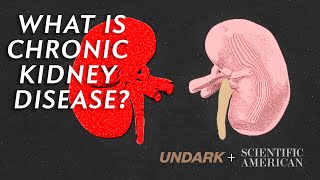 What is Chronic Kidney Disease and how does dialysis work [upl. by Imnubulo]