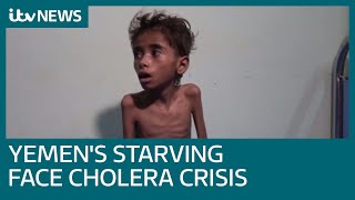 Yemens starving now face worlds worst cholera outbreak  ITV News [upl. by Pahl]