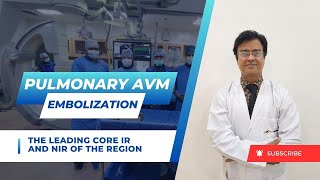 Pulmonary AVM Embolization  IRFACILITIES [upl. by Kim]