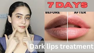 Darker lips treatment in just 7 days 🌸  say bye bye to pigmented lips 🤗  Manpreet Kaur youtube [upl. by Sidonie]