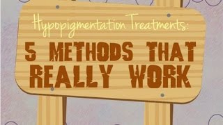 Hypopigmentation Treatments 5 Methods That Really Work [upl. by Biddle]