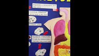 Lifecycle of Entamoeba histolytica [upl. by Ahsinor]