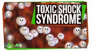 Toxic Shock Syndrome Way Beyond Tampons [upl. by Cynara94]