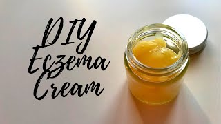 DIY Eczema Cream [upl. by Solberg]