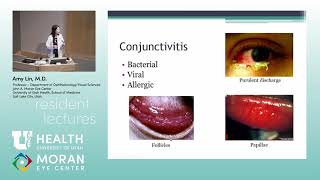 Introduction to Cornea [upl. by Remle422]