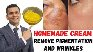 ONE SOLUTIONS FOR ALL SKIN PROBLEMS Cream To Remove Pigmentation And Wrinkles DrVivek Joshi [upl. by Ynnavoeg]