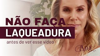 Não faça LAQUEADURA sem ver esse vídeo [upl. by Beichner]